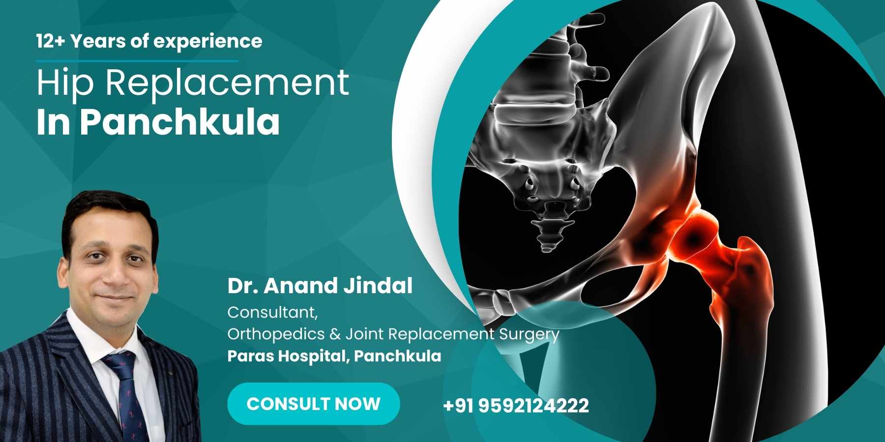 Best Hip Replacement in Panchkula Dr. Anand JIndal